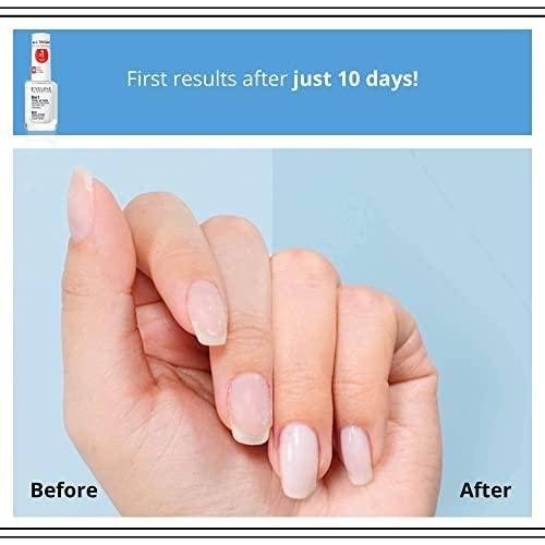 EVELINE Nail Therapy Sensitive 8in1 nail hardening treatment, 12 ml |  Mēness aptieka